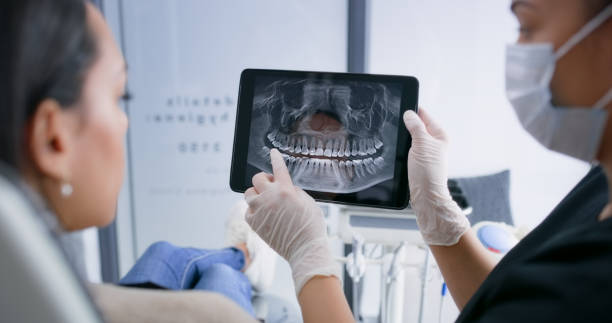 Licensed Tooth Extraction service in Wild Peach Village, TX - Smile Center Dentistry